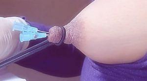 乳房　注射針乳首肥大化調教 私雨 アナル奴隷系SM調教ブログ